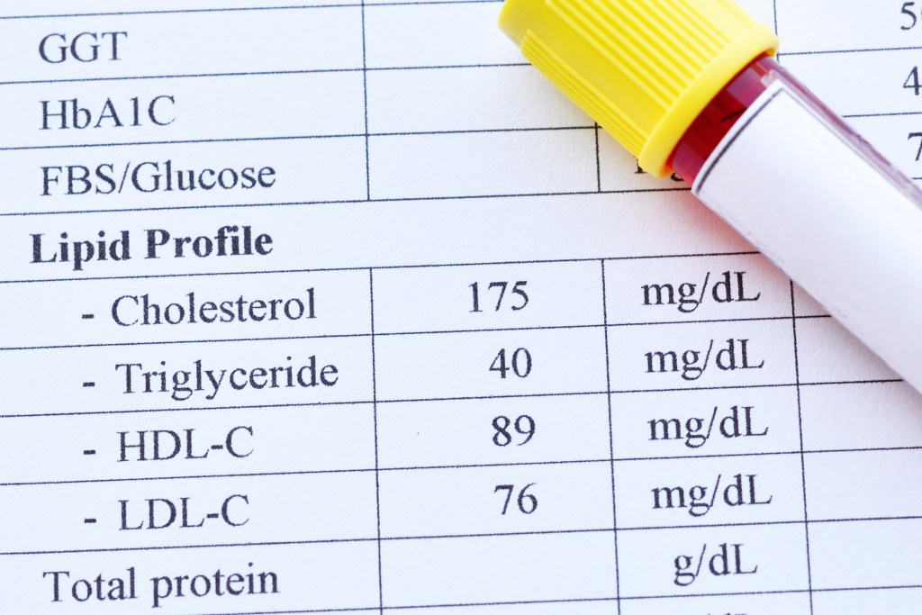 Lipid profile report