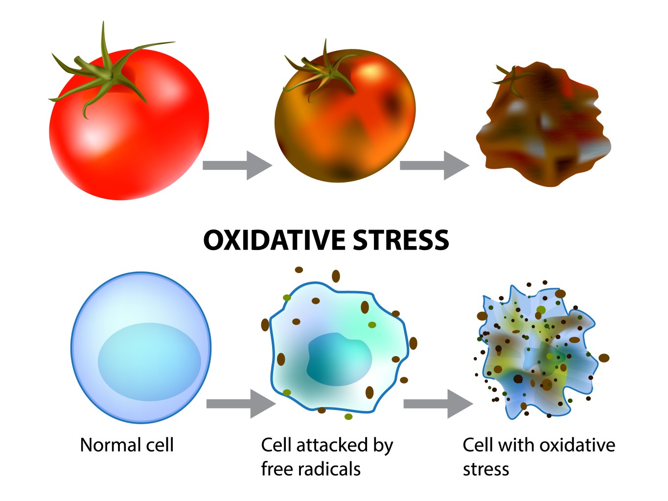 Oxidative stress model