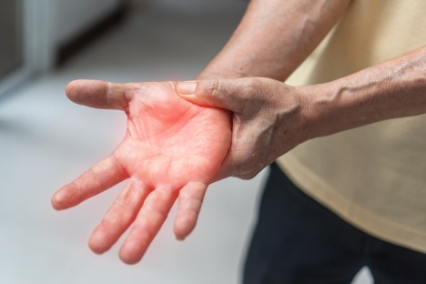 Peripheral Neuropathy: Causes, Symptoms, and Natural Support