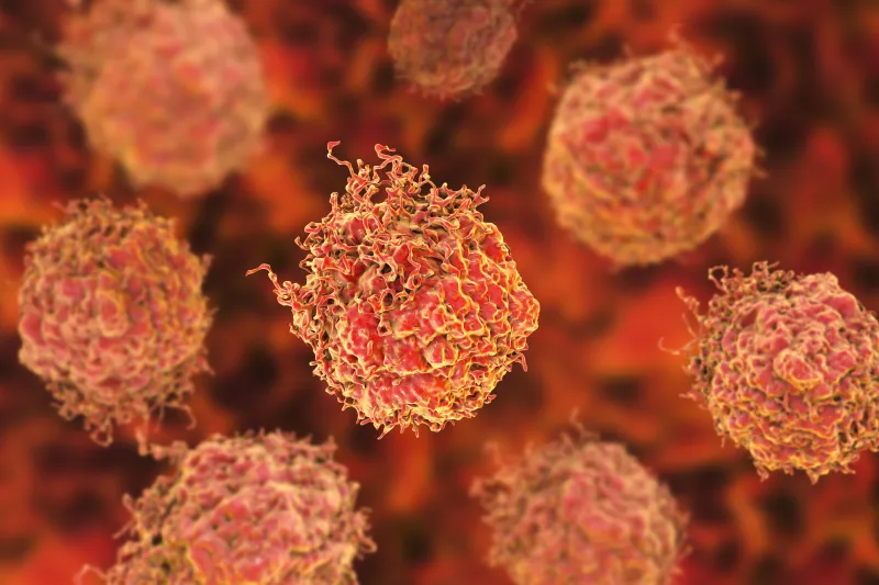 Prostate cancer management