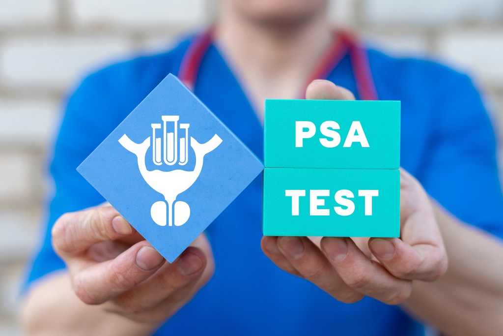 PSA test concept 