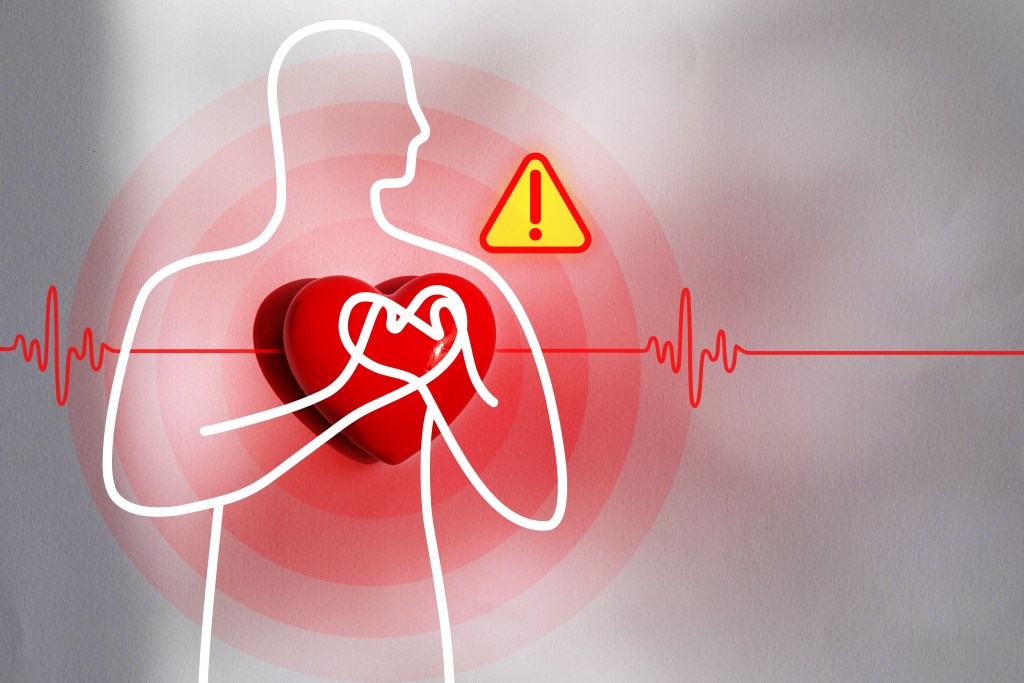 High blood pressure illustration