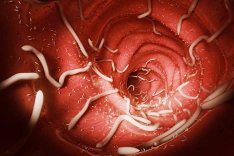 How to Kill Parasites: 7 Natural Tips