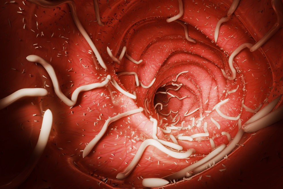 How to Kill Parasites: 7 Natural Tips