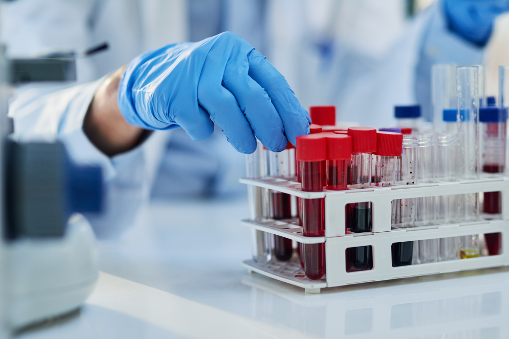 Blood test