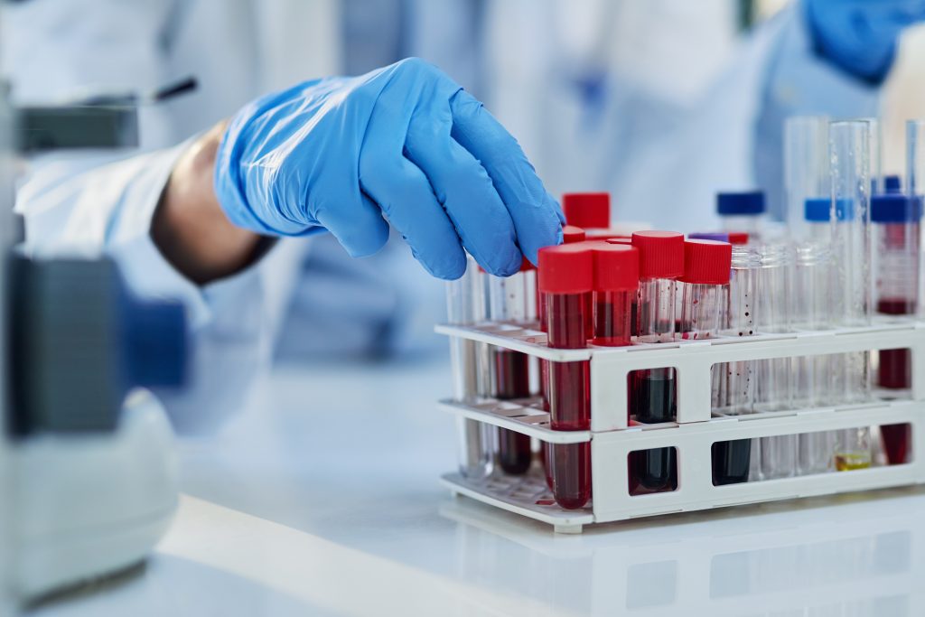 Blood test