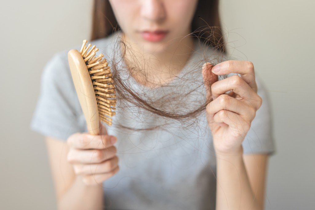 Hair loss concept
