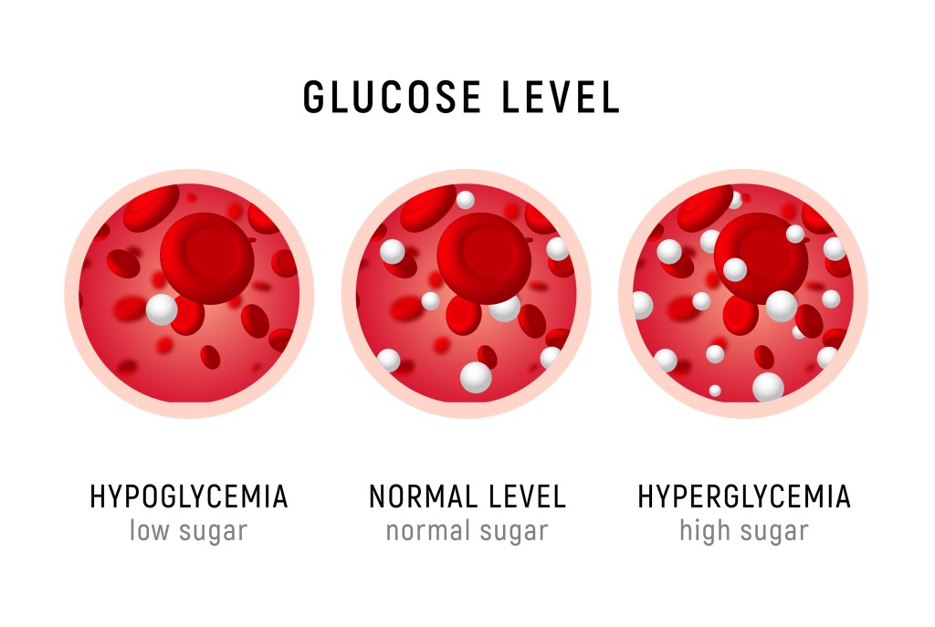 different blood sugar levels   