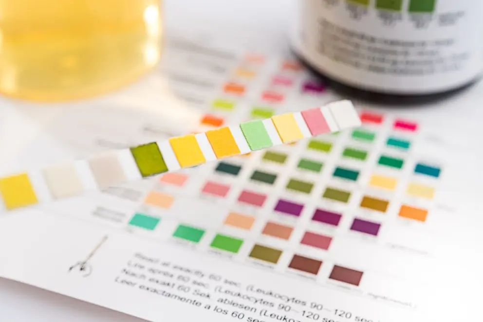 Ketone test strips