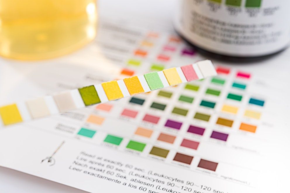 Ketone test strips