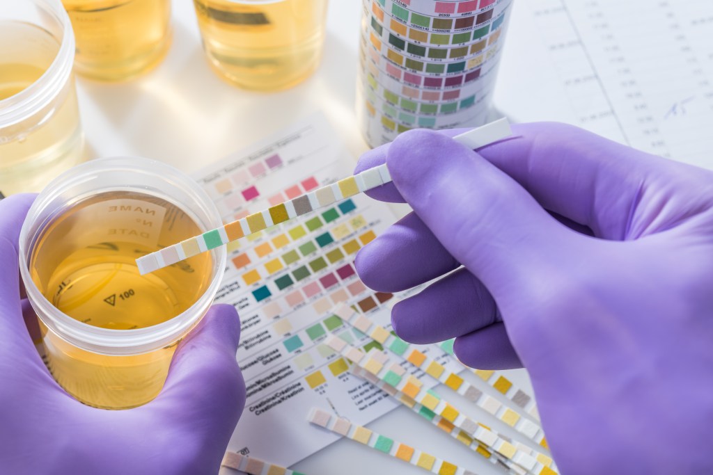 Urine test chart