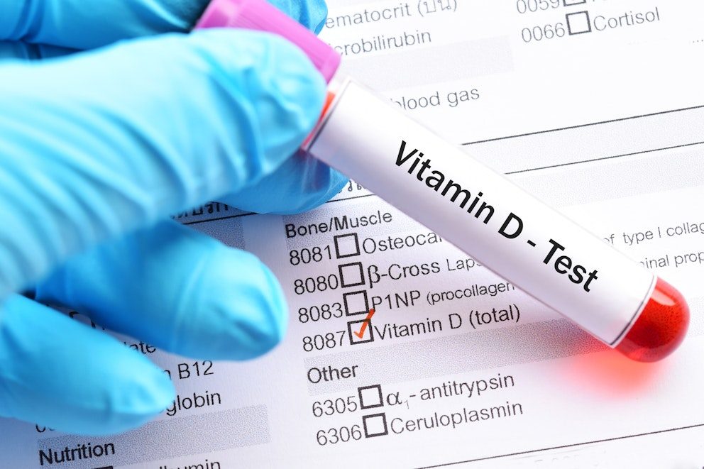 Testing for vitamin D
