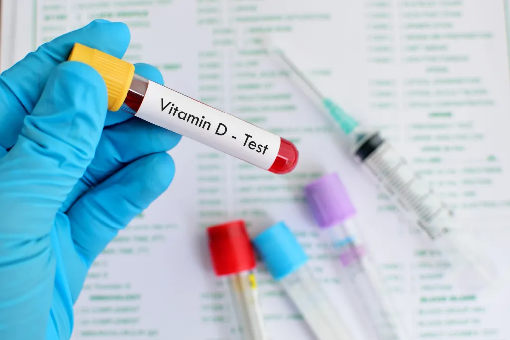 Vitamin D blood serum test