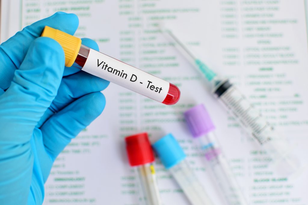 Vitamin D blood serum test