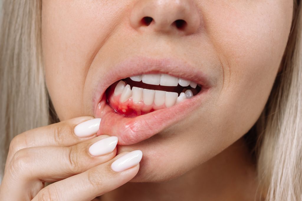 Woman with gum disease
