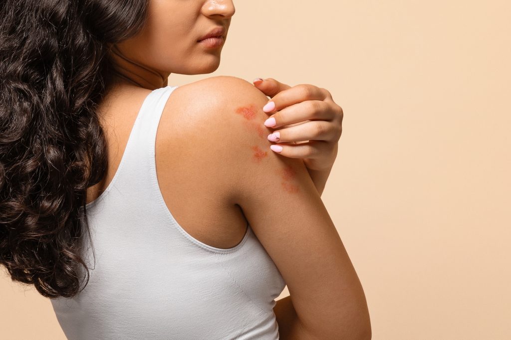 Woman with itchy skin
