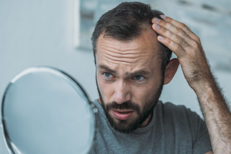 Man with a receding hairline