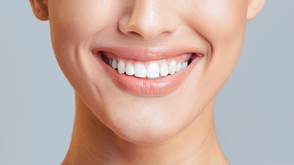 Woman with white teeth