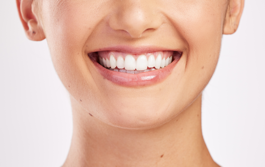Close up of a woman's face and teeth