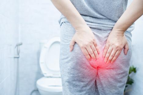 The Best Homeopathic Remedy for Hemorrhoids