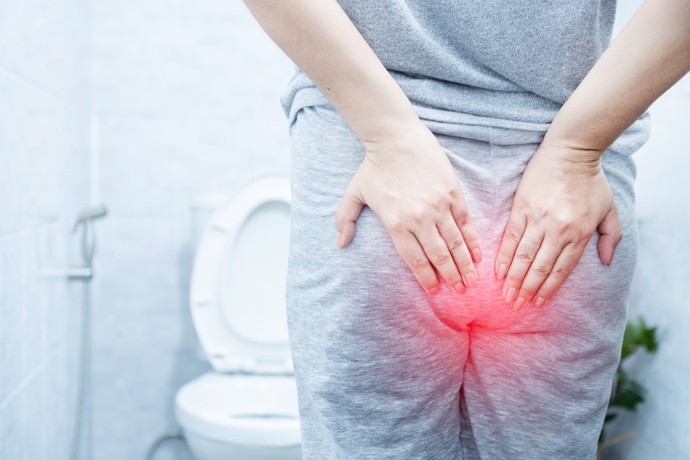 The Best Homeopathic Remedy for Hemorrhoids