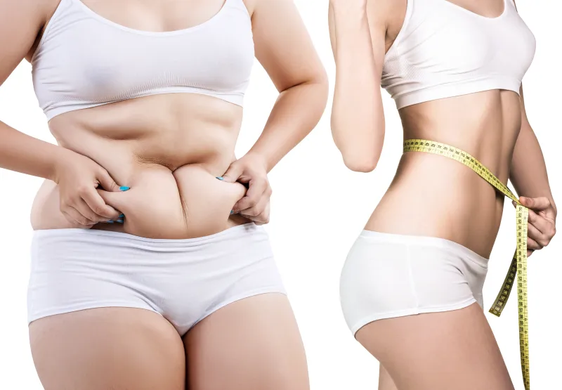 Before and after weight loss
