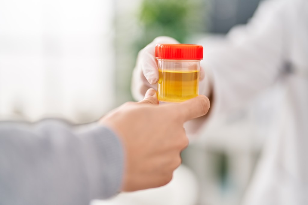 Holding urine sample