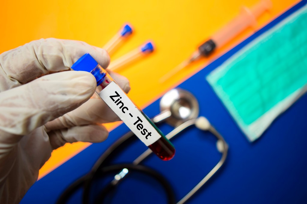 Zinc test