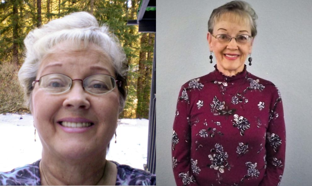 Before and after image of Kay Oxford