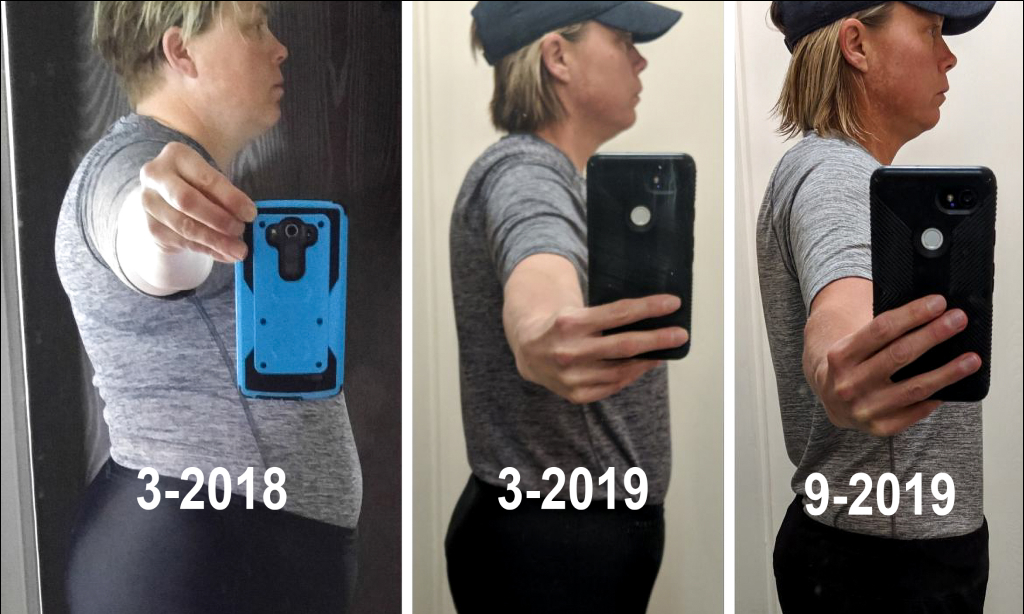 Before and after photos of Kathleen Wischmeier