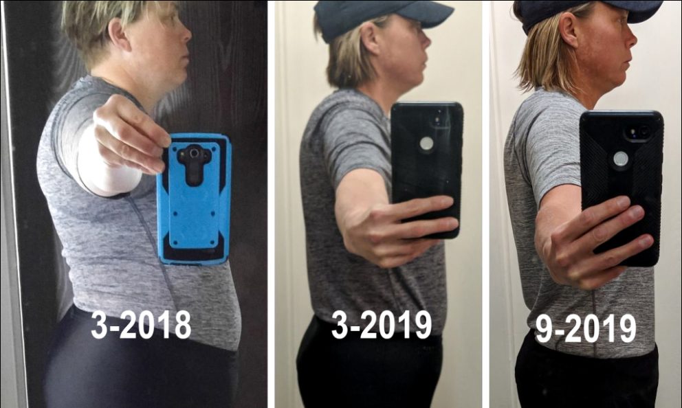 Before and after photos of Kathleen Wischmeier