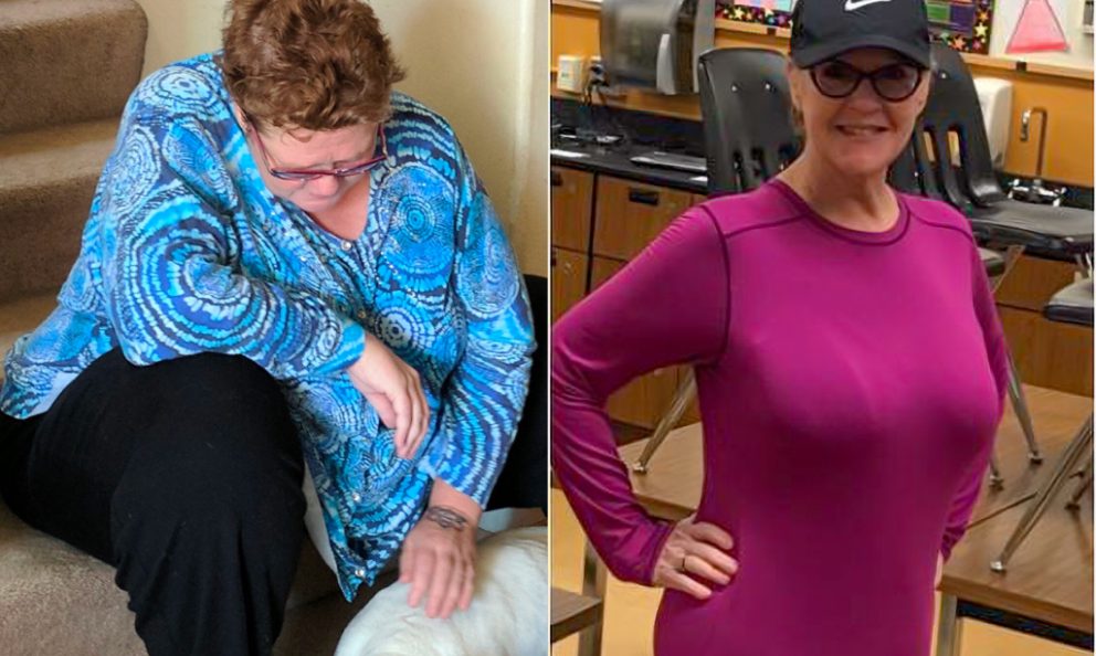 Before and after image of Patty Burn
