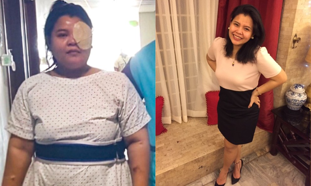How Keto Helped Me Lose 62 Pounds and Reclaim My Health&nbsp;&nbsp;