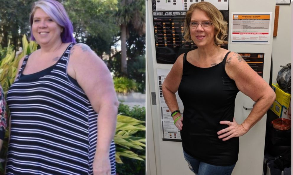Before and after image of Jennifer Christmas