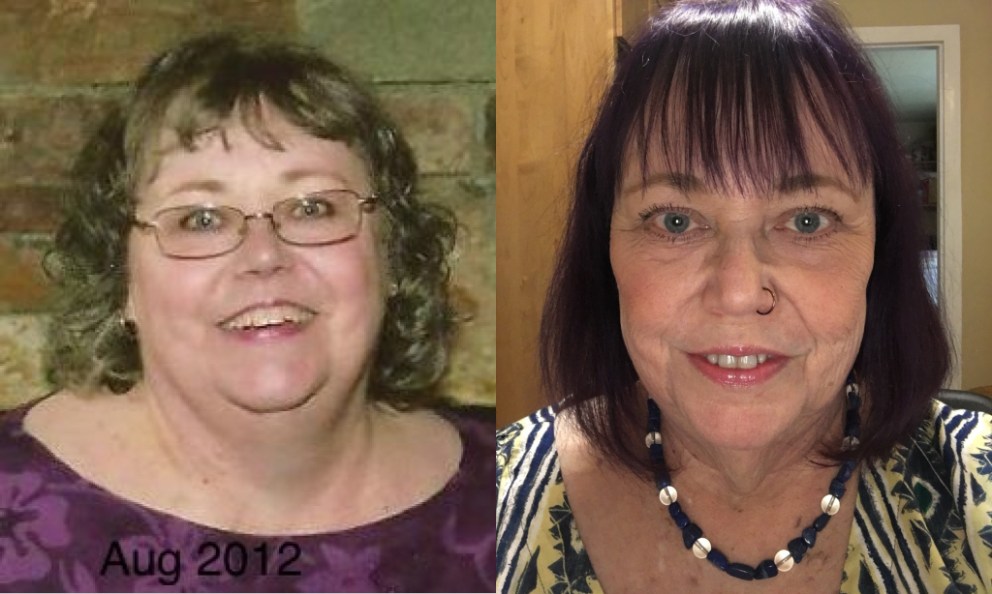Denise Lost 167 Pounds with Keto and Reclaimed Her Health at 64&nbsp;