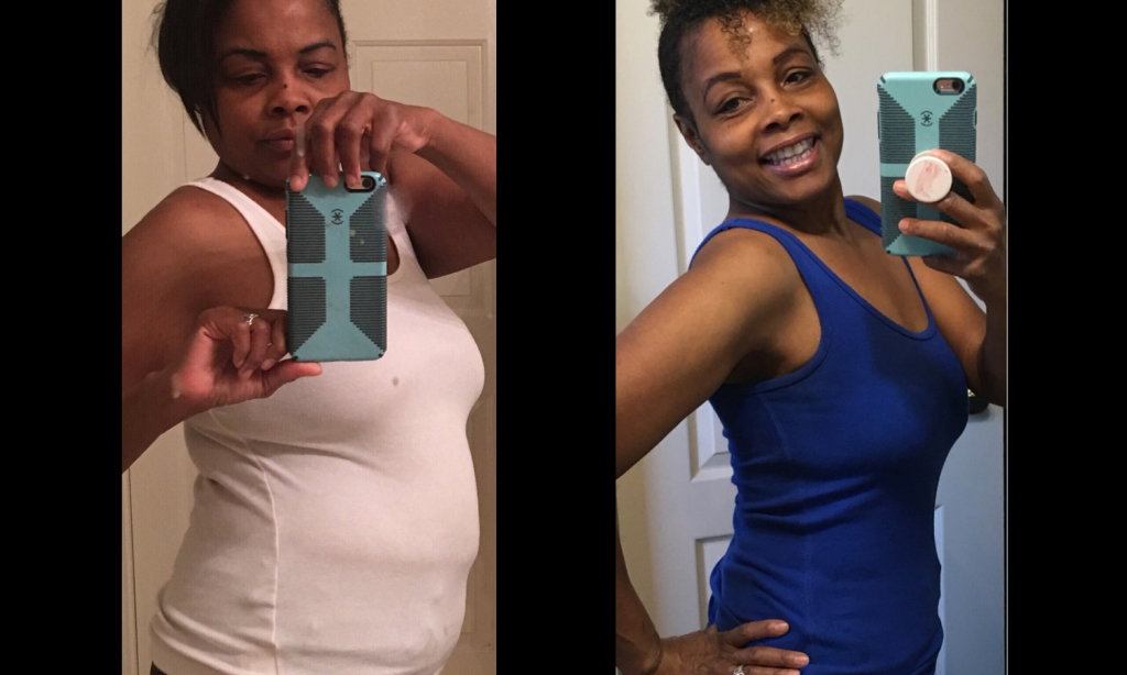 Before and after image of Rosemarie Hilton