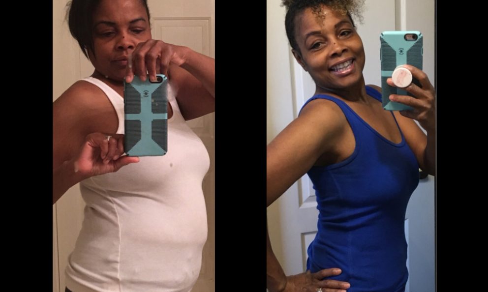 Before and after image of Rosemarie Hilton