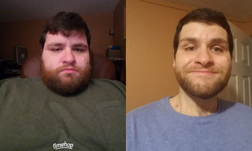 Edward Lost 170 Pounds with Keto After Years of Unhealthy Habits