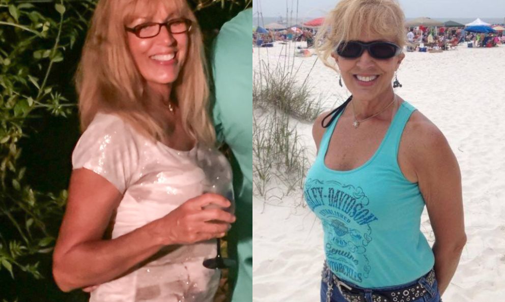 Before and after image of Sherry Neville