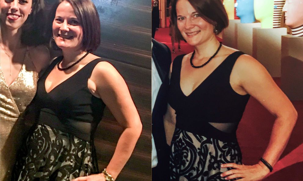 Before and after image of Renee