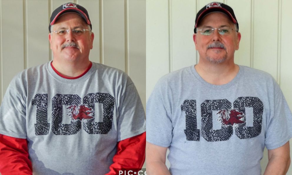 Before and after image of Robbie Robinson