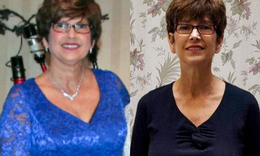Before and after image of Jan Keefe