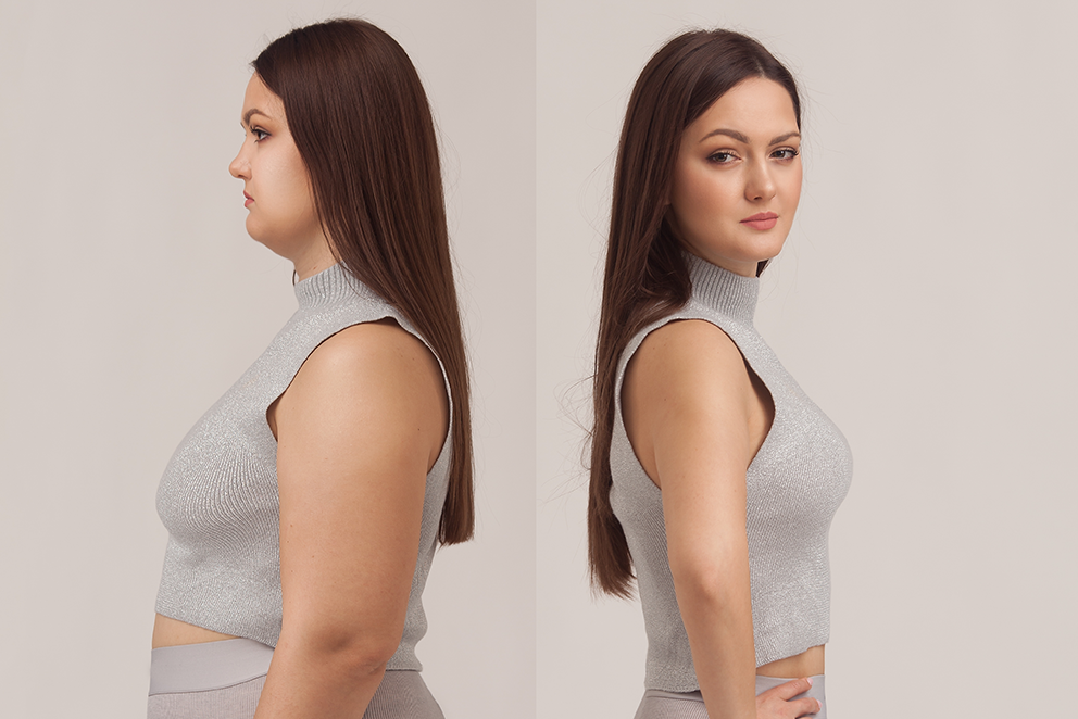 Before and after body transformation