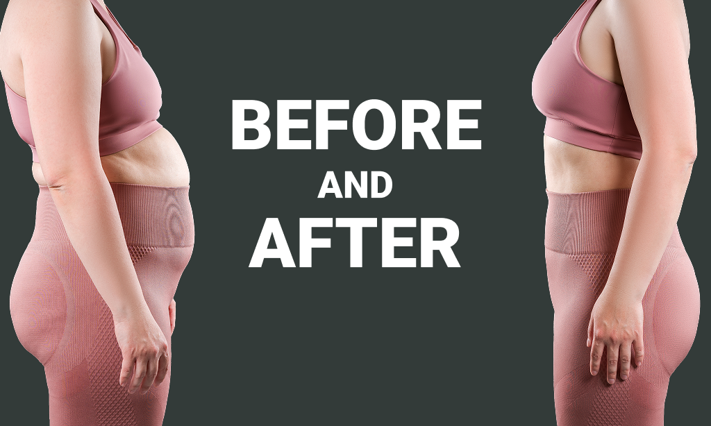 Weight loss transformation comparison image female