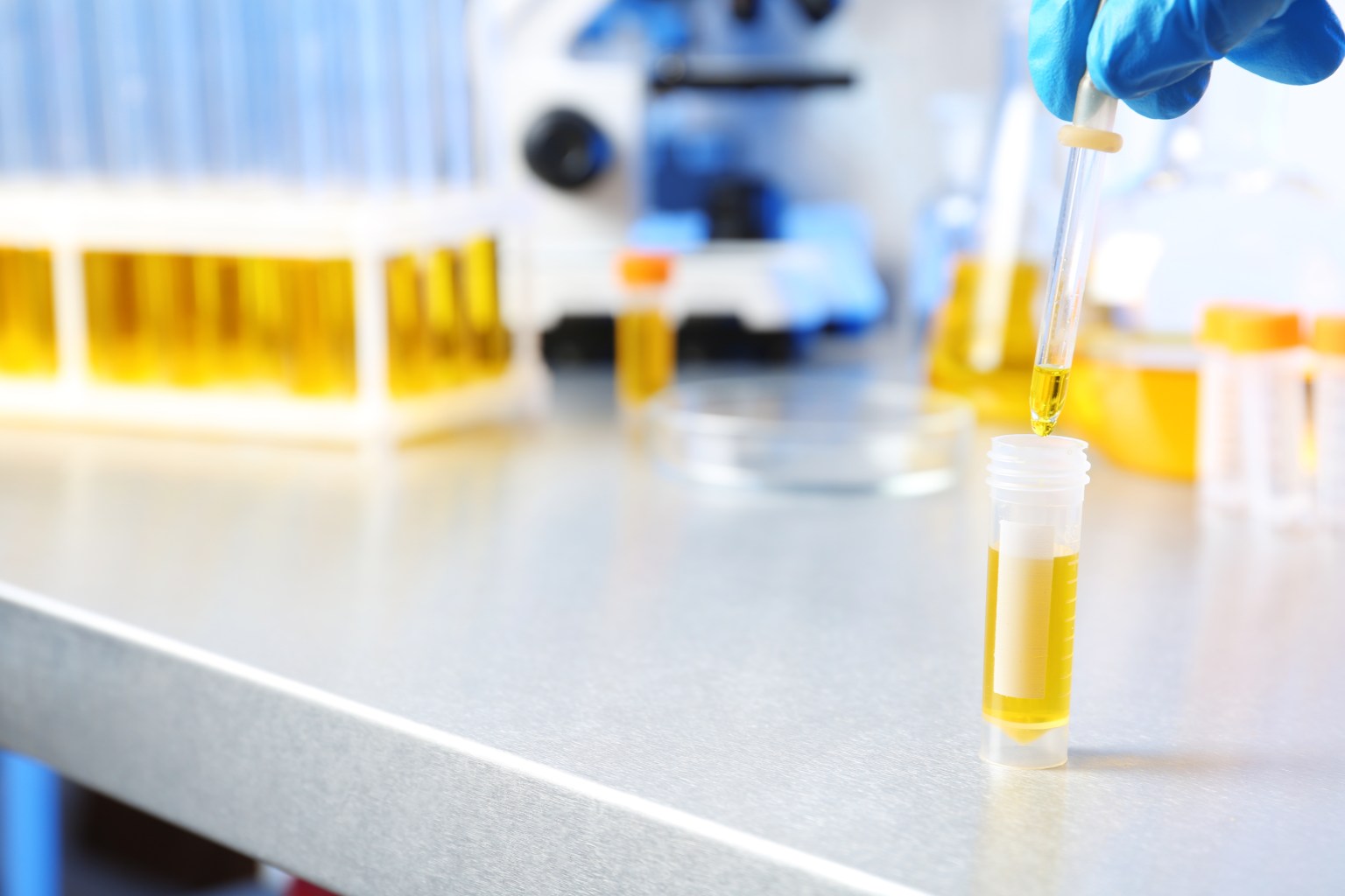 Urine sample 