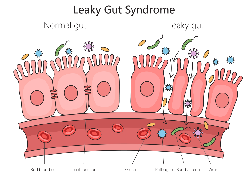 Leaky gut illustration