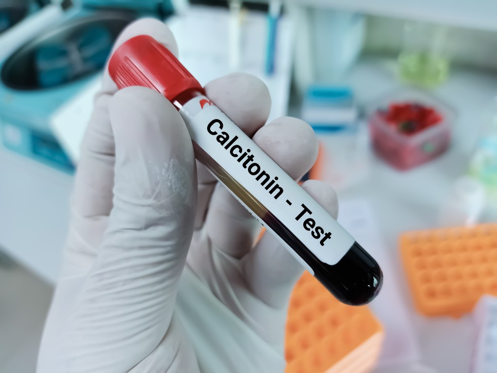 Calcitonin blood test