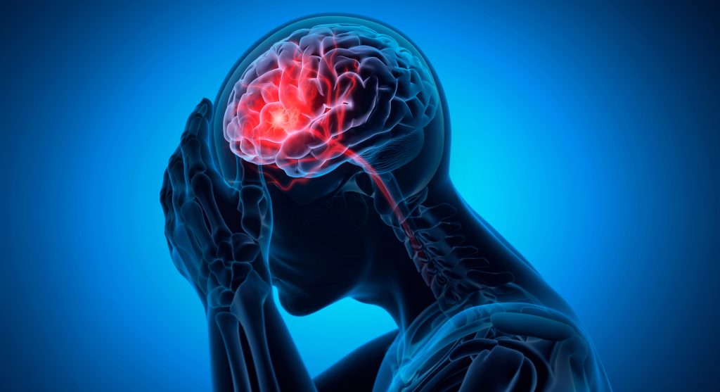 Headache illustration