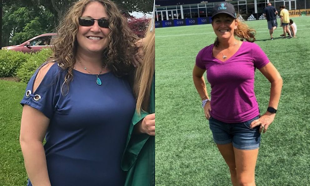 Before and after image of Michelle M