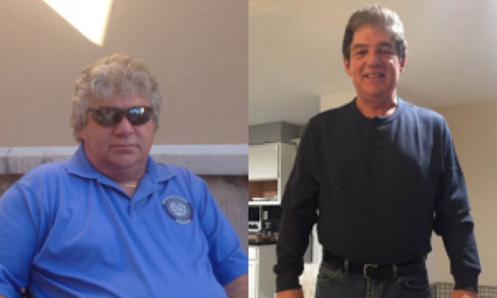 Before and after image of Carey Allen